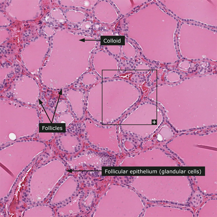 Dictionary Normal Thyroid Gland The Human Protein Atlas