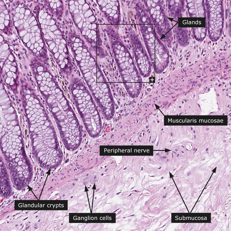 Dictionary - Normal: Rectum - The Human Protein Atlas